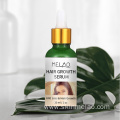 Hair Growth Serum Anti Hair Loss Damaged